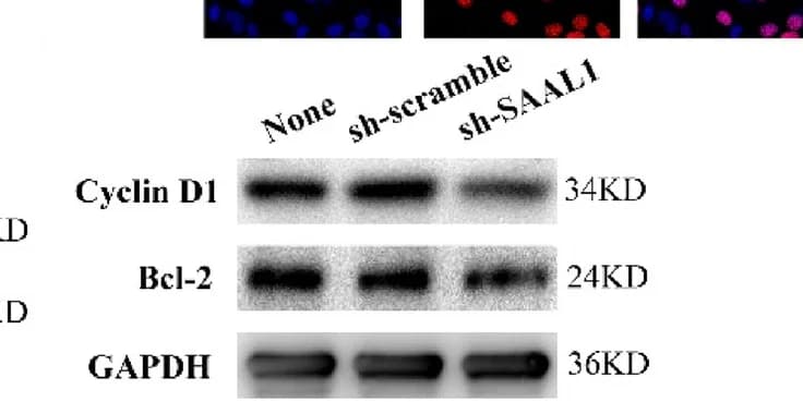 Open access visualization of Microscopy, Gel, Cyclin D1, Bcl-2, A549 Cell Model