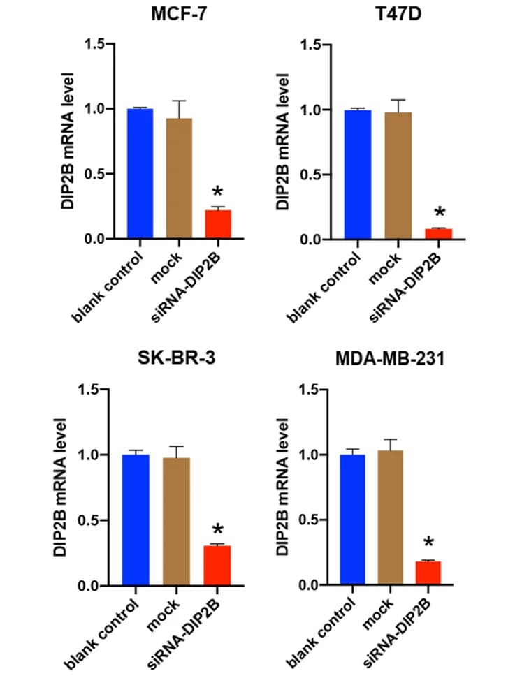 Open access visualization of Bar Plot, Error Bars, Real-time PCR, DIP2B mRNA, GAPDH mRNA