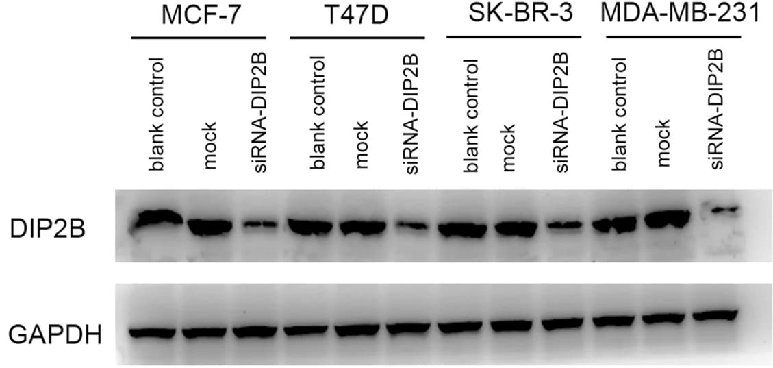 Open access visualization of Gel, Western Blotting, DIP2B protein, GAPDH protein, Breast Cancer Cells