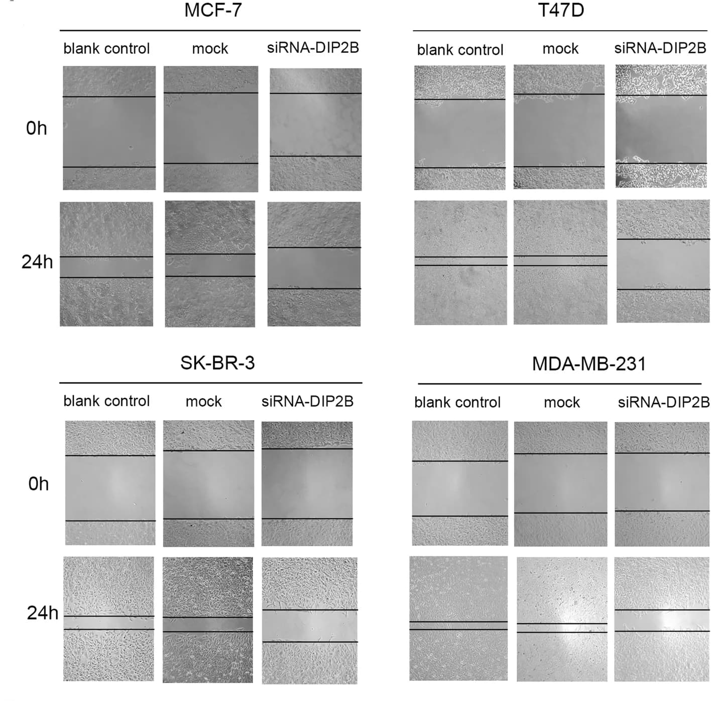 Open access visualization of Microscopy, Wound-healing assay, Breast Cancer Cell Lines, siRNA, Cell Migration