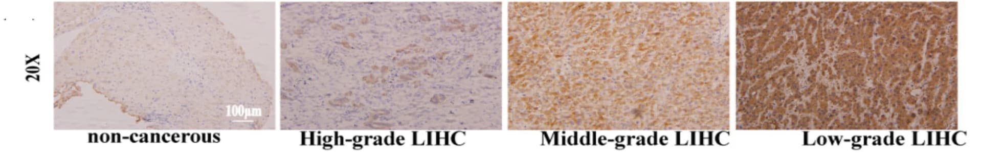 Open access visualization of Microscopy, IHC Images, DTL Staining, LIHC Tissues, Normal Tissues