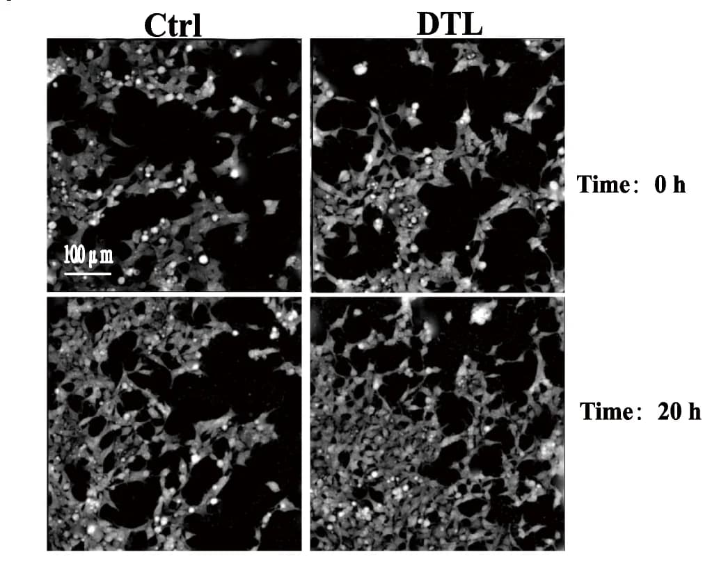 Open access visualization of Microscopy, HEK293-Ctrl Cells, HEK293-DTL Cells, Live Cell Imaging