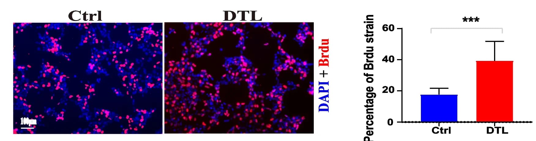 Open access visualization of Bar Plot, Error Bars, Microscopy, BrdU Staining, HEK293-Ctrl Cells