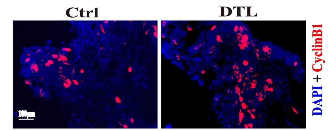 Open access visualization of Microscopy, CyclinB1 Staining, HEK293-Ctrl Cells, HEK293-DTL Cells, DAPI Staining