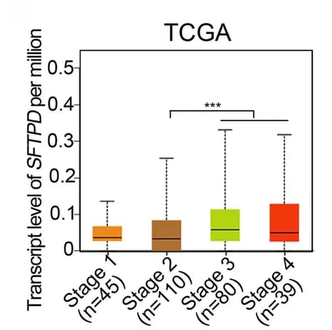 Open access visualization of Box Plot, mRNA expression, Colorectal Cancer Stages, TCGA database, UALCAN
