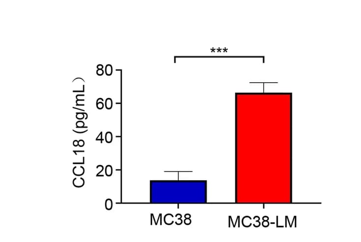 Open access visualization of Bar Plot, Error Bars, CCL18 Expression, Culture Medium, Lung Metastasis