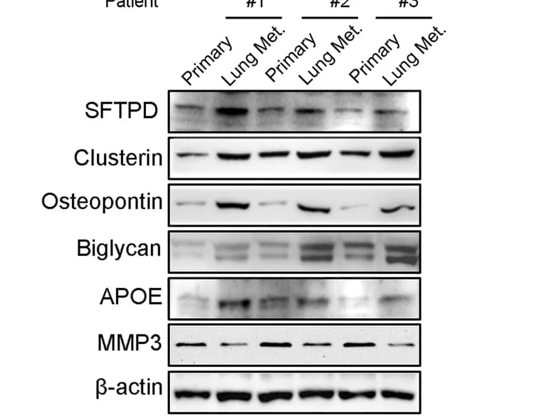 Open access visualization of Gel, Protein Levels, SFTPD, Clusterin, Osteopontin