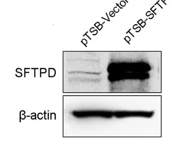 Open access visualization of Gel, Western Blotting, SFTPD, MC38-Luc Cells, Overexpression