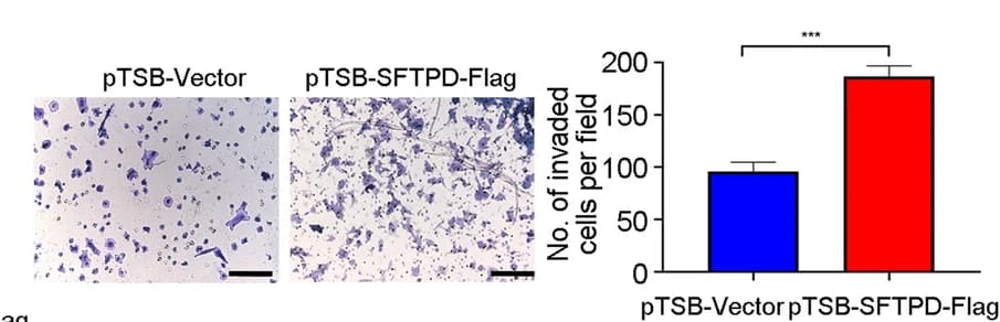 Open access visualization of Bar Plot, Error Bars, Microscopy, Cell Invasion, MC38-Luc Cells
