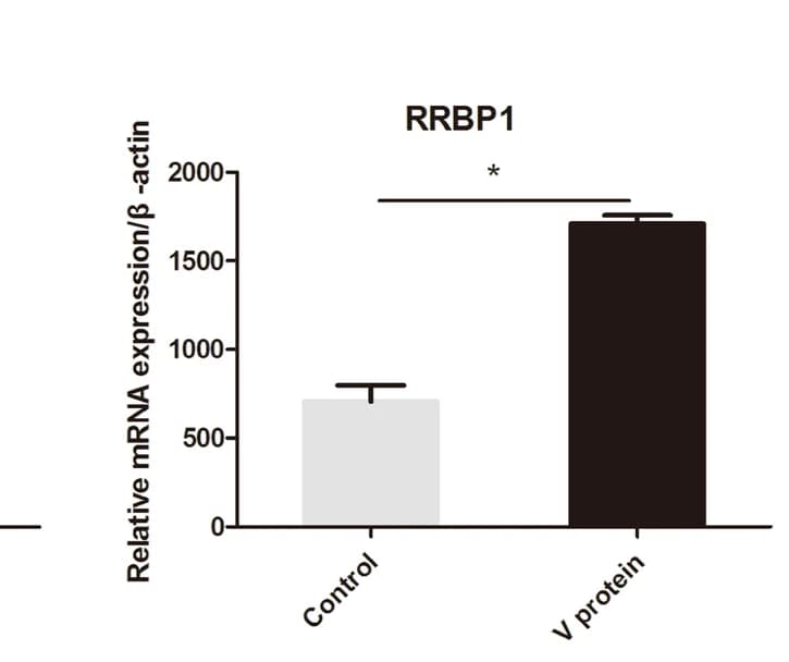 Open access visualization of Bar Plot, Error Bars, qPCR, Gene Expression, V Protein