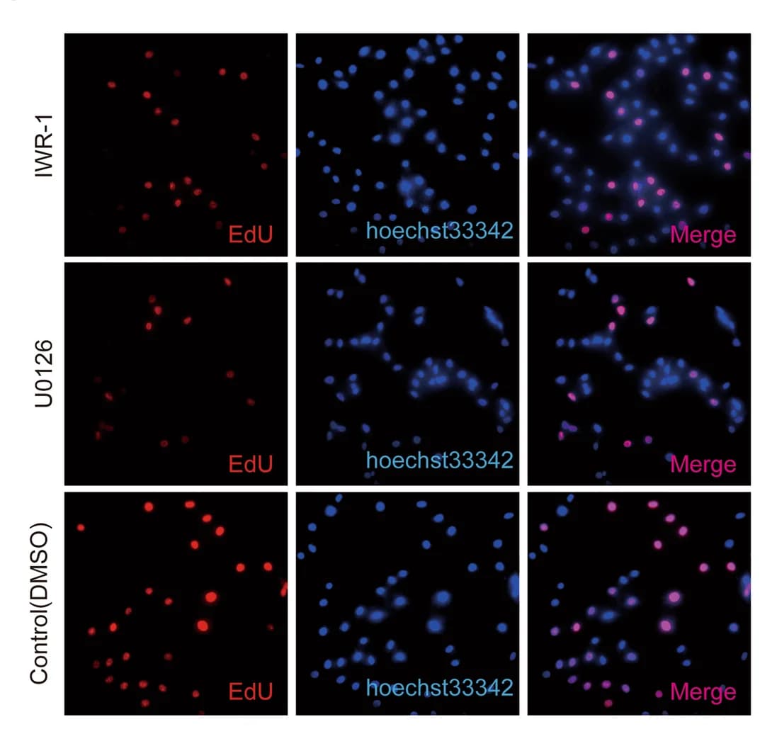 Open access visualization of Microscopy, U0126, IWR-1, EdU, Hoechst 33,342