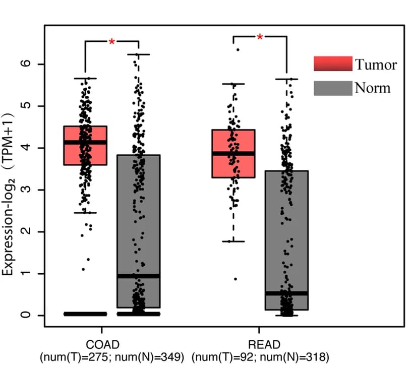 Open access visualization of Box Plot, Scatter Plot, SLC27A2, CRC, GEPIA Database