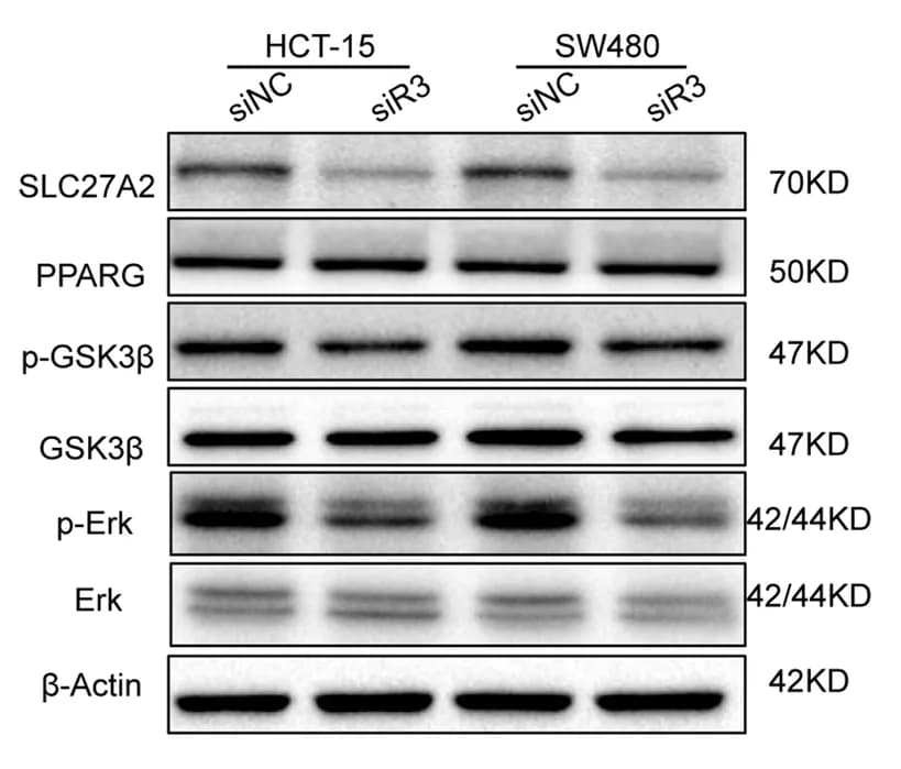 Open access visualization of Gel, SLC27A2, PPARG, p-GSK3, GSK3