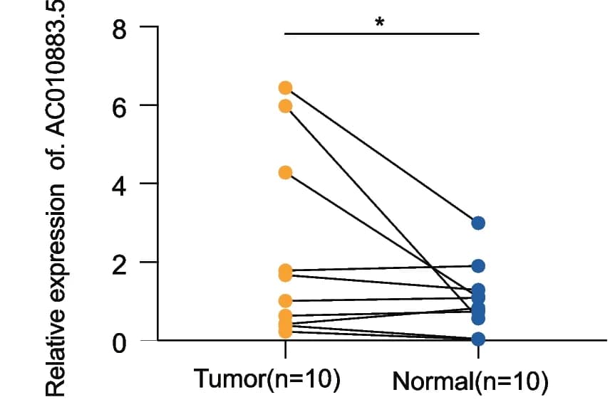 Open access visualization of Scatter Plot, qRT-PCR, AC010883.5, Cervical Cancer, Cervical Tissues