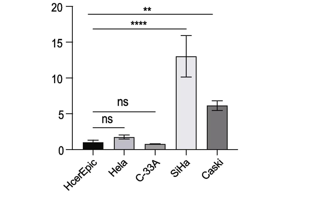 Open access visualization of Bar Plot, Error Bars, qRT-PCR, AC010883.5, Cervical Cancer Cell Lines