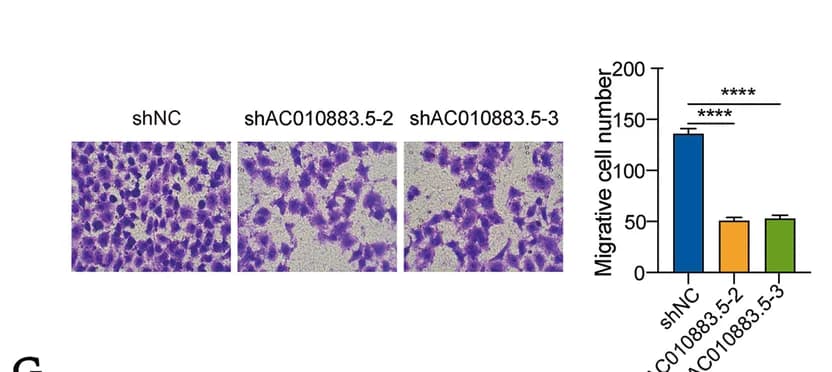 Open access visualization of Bar Plot, Microscopy, Transwell Migration, SiHa Cells, AC010883.5 treatment