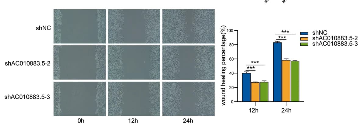 Open access visualization of Bar Plot, Error Bars, Microscopy, Wound Healing, SiHa Cells