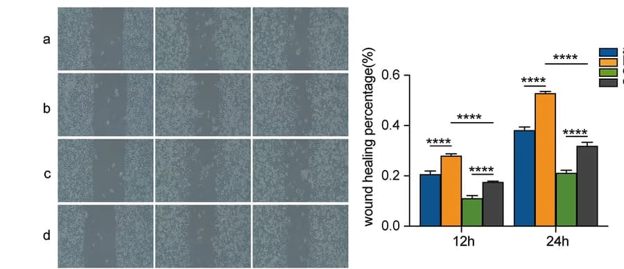 Open access visualization of Bar Plot, Error Bars, Microscopy, Wound Healing Assay, C-33A Cells