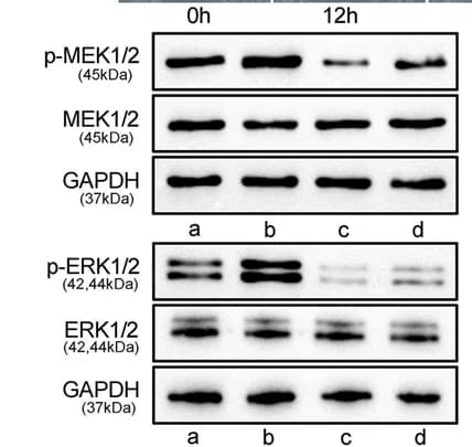 Open access visualization of Gel, Western Blots, MAPK Signaling, PD98059, C-33A Cells