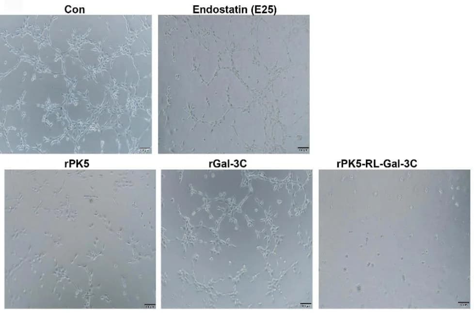 Open access visualization of Microscopy, Tube Formation, In Vitro, Angiogenesis