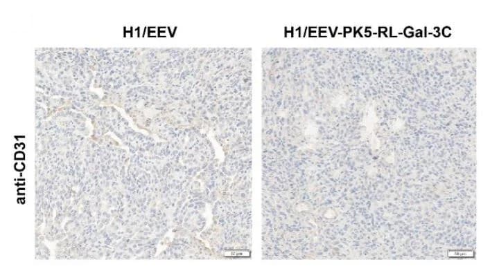 Open access visualization of Microscopy, CD31, Tumor Tissues, IHC