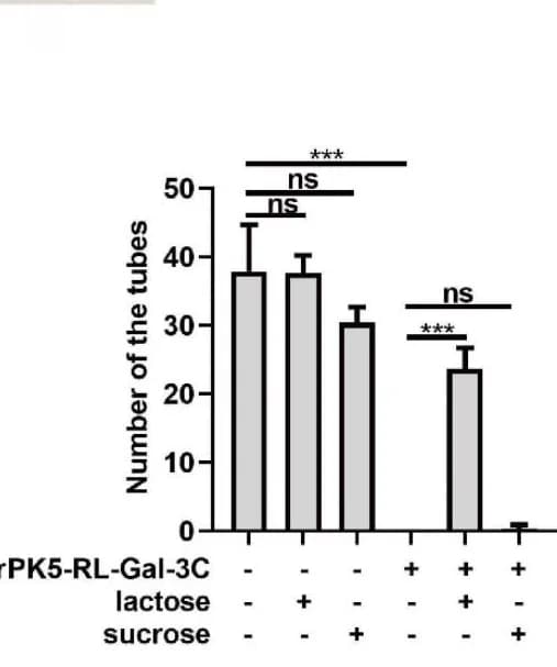 Open access visualization of Bar Plot, Error Bars, Lactose, Sucrose, Inhibition