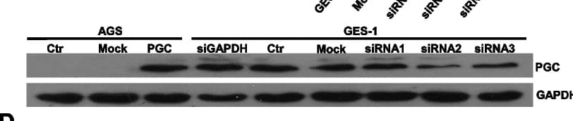 Open access visualization of Gel, Western Blot, Transfection, siRNA, Plasmid