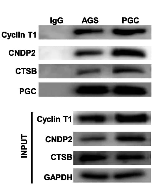 Open access visualization of Gel, Co-IP, PGC, CCNT1, CNDP2