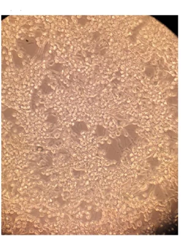 Open access visualization of Microscopy, U87 Cells, Ad/GFP/IL-24