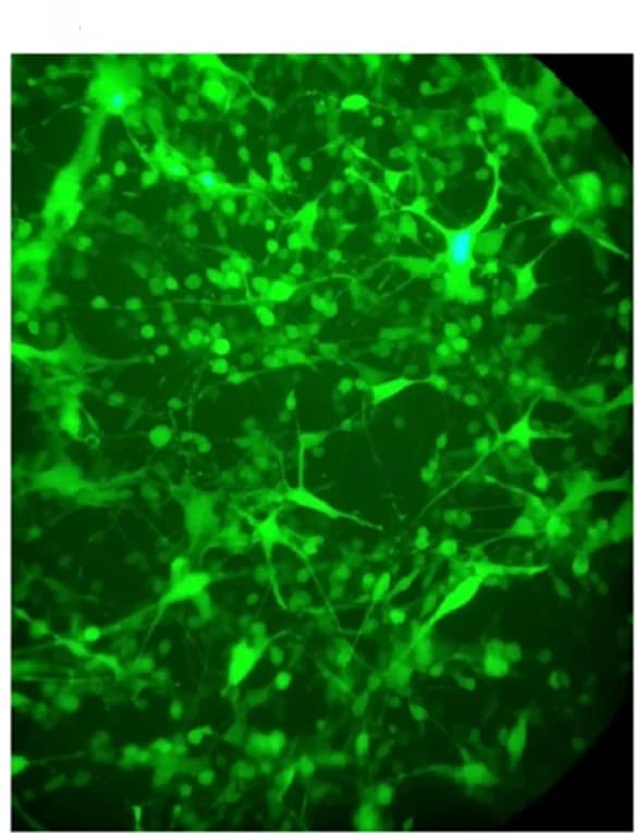 Open access visualization of Microscopy, Green Fluorescent Protein, GFP Expression, Fluorescence Microscopy