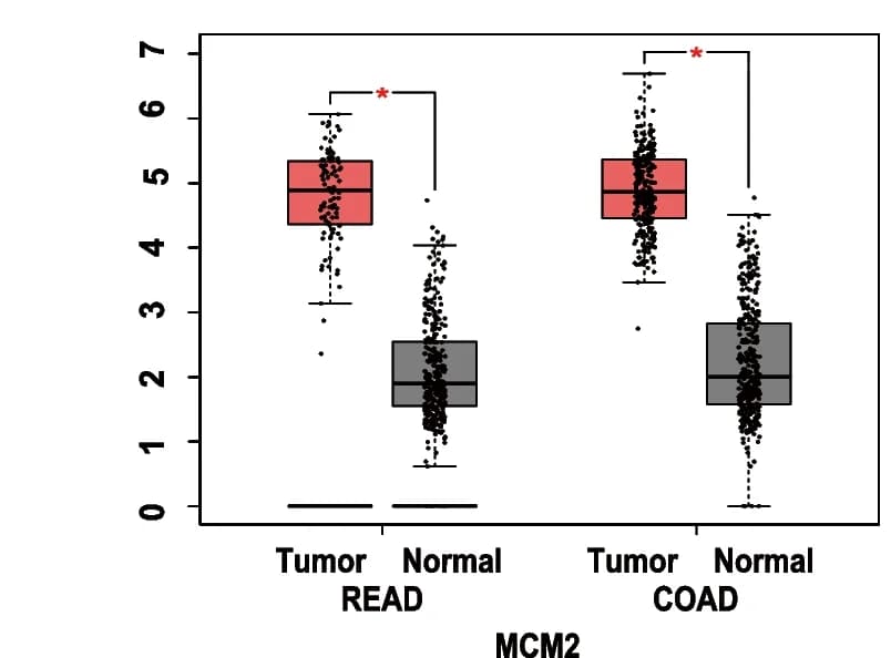 Open access visualization of Box Plot, Scatter Plot, CGREF1, Colorectal Cancer Tissue, Normal Tissue