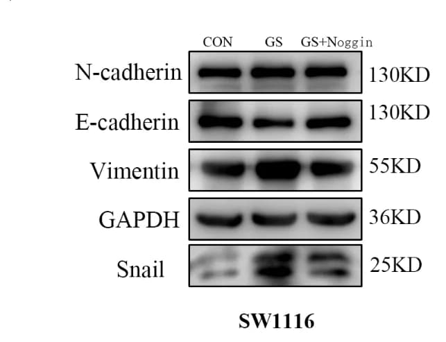 Open access visualization of Gel, EMT, SW1116 Cells, MC38 Cells, BMP4-Smad Pathway