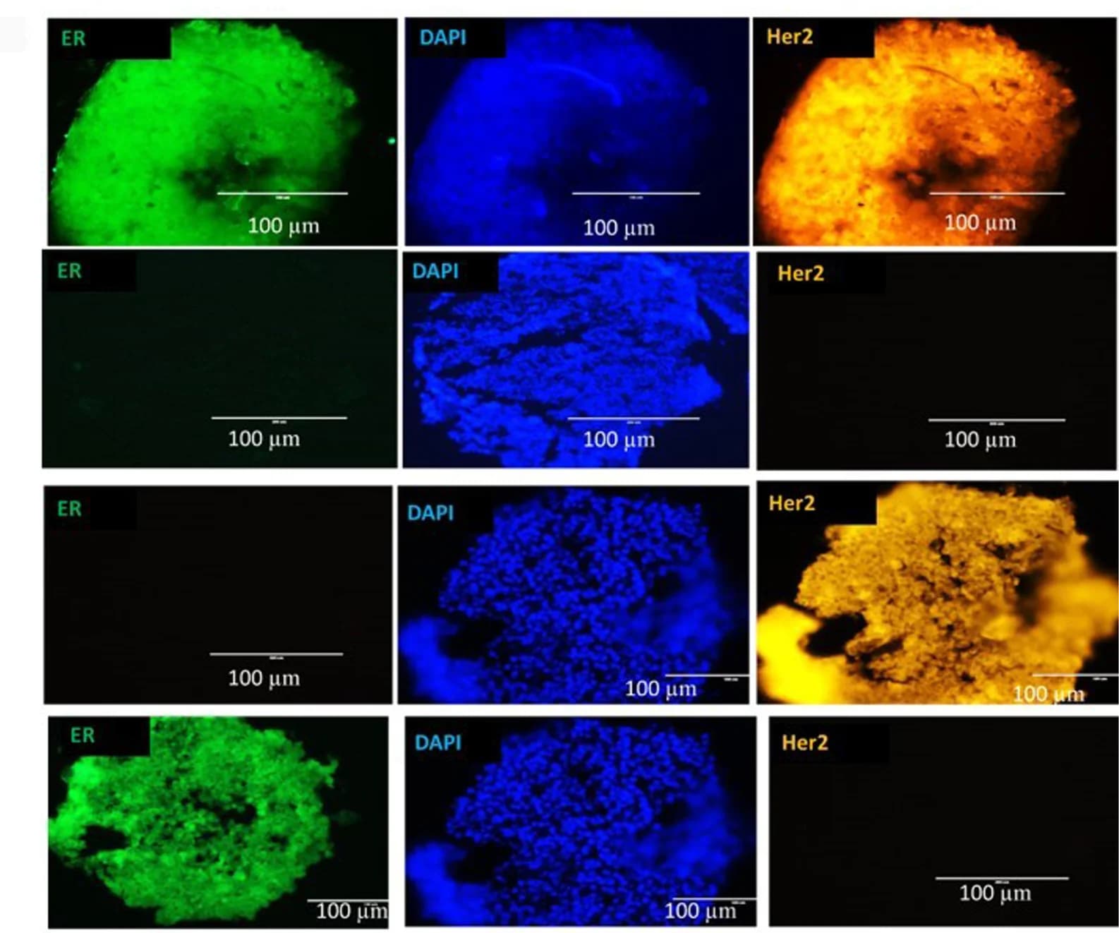 Open access visualization of Microscopy, Organoids, Histology, Breast Cancer, Immunohistochemistry