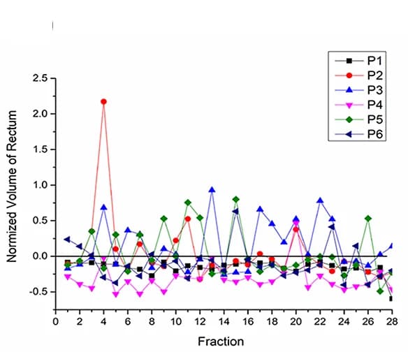 Open access visualization of Line Plot, Rectum Volume