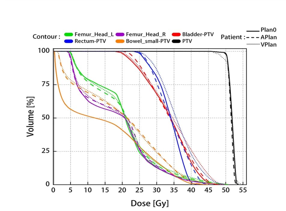 Open access visualization of Line Plot, Dose Volume Histograms, Virtual Planning, Adaptive Planning