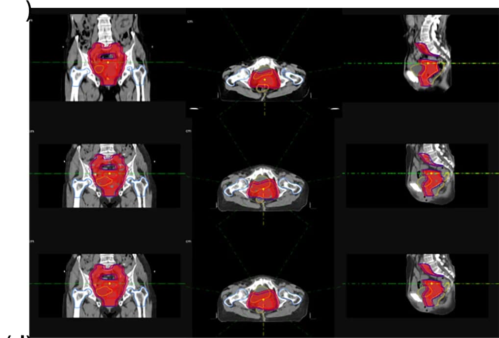 Open access visualization of Photo, Dose distribution, Plan0, VPlan, APlan