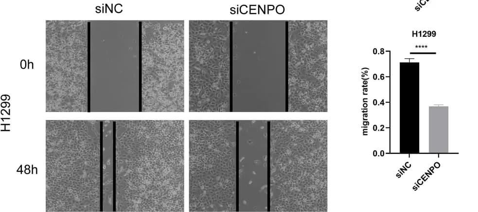 Open access visualization of Bar Plot, Error Bars, Microscopy, Photo, CENPO Knockdown