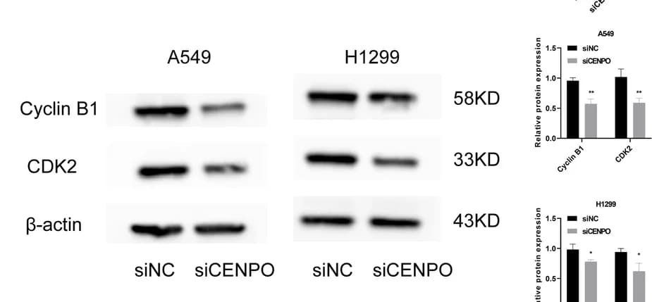 Open access visualization of Bar Plot, Error Bars, Gel, Western Blot, CDK2 Expression