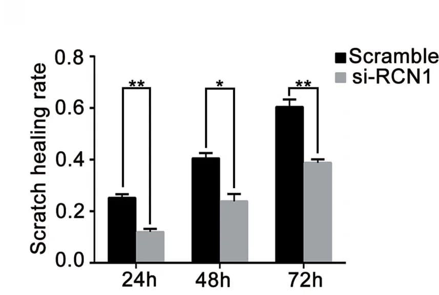 Open access visualization of Bar Plot, Error Bars, Clustered, Cell Migration, RCN1