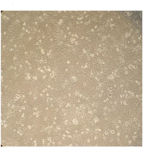 Open access visualization of Microscopy, HEp-2 Cells, Uninfected