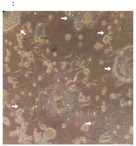 Open access visualization of Microscopy, HEp-2 Cells, RSV-A2, CPE, Syncytia