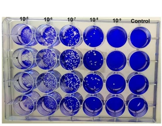 Open access visualization of Gel, HEp-2 Cells, RSV-A2, Serial Dilutions, Crystal Violet