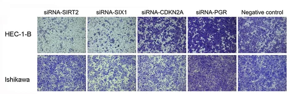 Open access visualization of Microscopy, Migration, Wound Healing Assay, Ishikawa Cell Line
