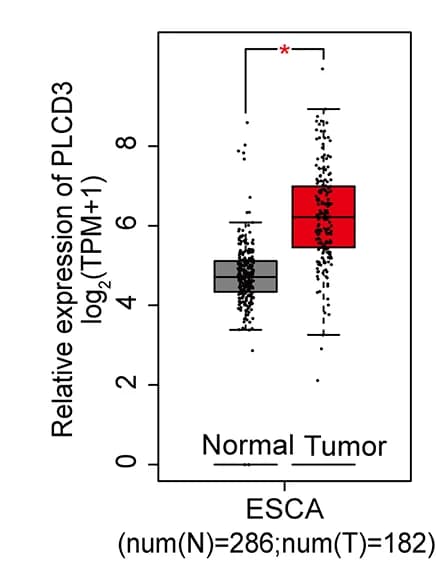 Open access visualization of Box Plot, Scatter Plot, GEPIA, PLCD3, Esophageal Cancer Tissues