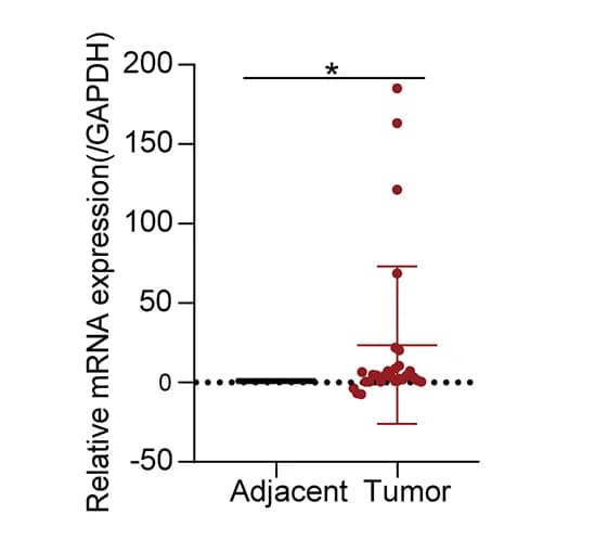 Open access visualization of Scatter Plot, Error Bars, PLCD3, ESCC Tissues, Non-Tumor Tissues