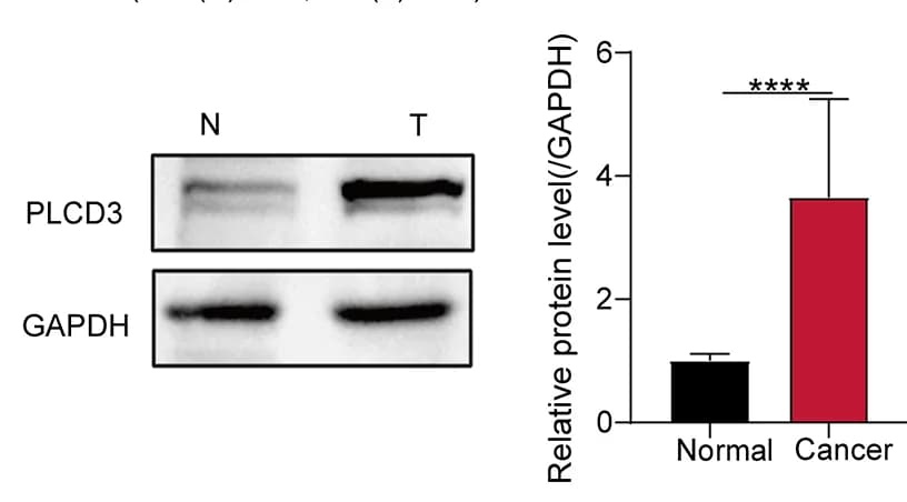 Open access visualization of Bar Plot, Error Bars, Gel, PLCD3, ESCC Tissues