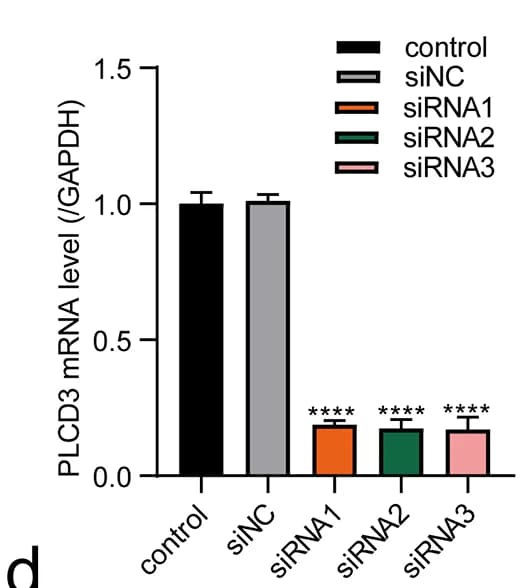 Open access visualization of Bar Plot, Error Bars, Tumor Cell Proliferation, Migration, Invasion