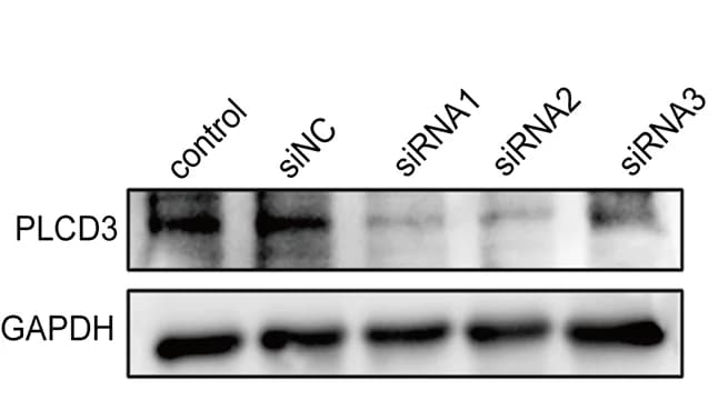 Open access visualization of Gel, PLCD3 Knockdown, ECA109 Cells, siRNA, qRT-PCR