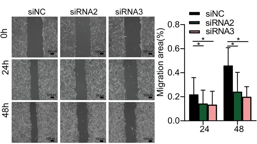 Open access visualization of Bar Plot, Error Bars, Microscopy, Wound Healing Assay, Mobility