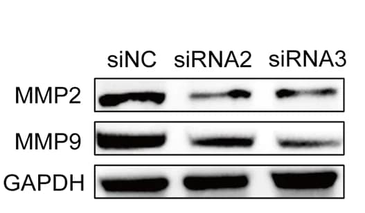 Open access visualization of Gel, WB, Migration-Related Proteins, MMP2, MMP9